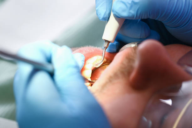 Best Emergency Treatment for Toothache in Fort Bliss, TX
